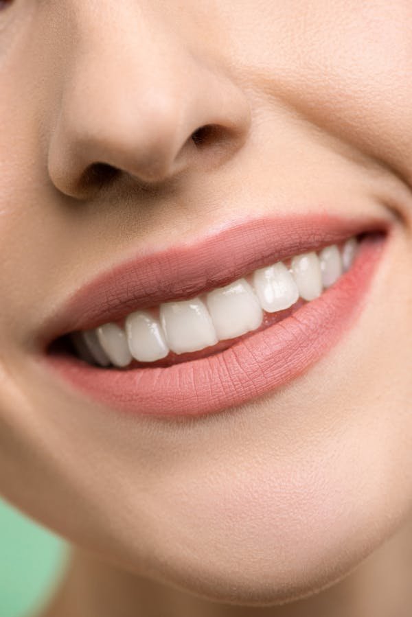 Optimisez votre sourire avec le détartreur dentaire ultrason